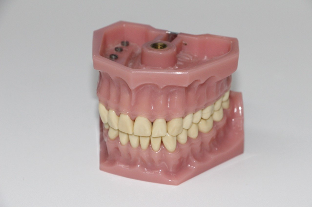 Dentures­